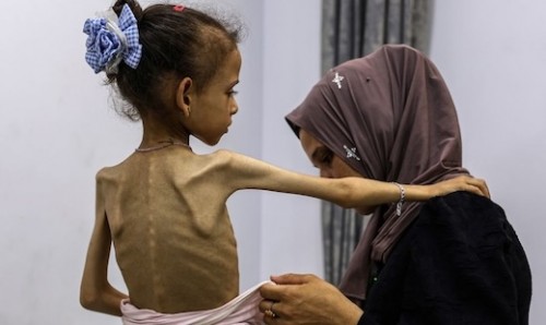 Come la scusa della "diffamazione del sangue" tappa la bocca all'Occidente sul genocidio di Gaza